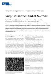 Surpises in the land of the Microns - BEGO