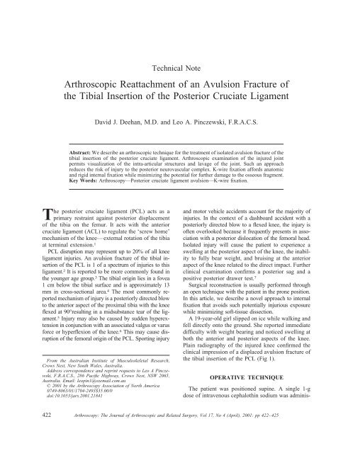 Arthroscopic Reattachment of an Avulsion Fracture of the Tibial ...