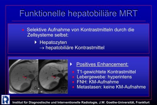 Institut fÃ¼r Diagnostische und Interventionelle Radiologie, JW ...