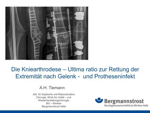 Die Kniearthrodese - Septische Chirurgie