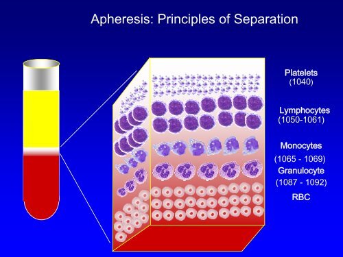 Apheresis: Basic Principles, Practical Considerations and