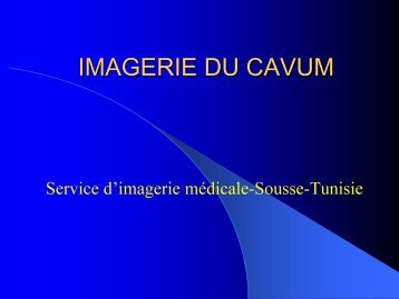 IMAGERIE DU CAVUM