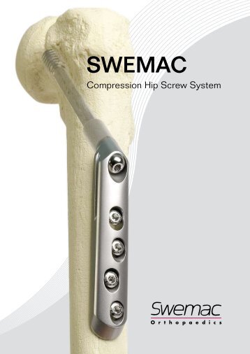 sWemaC - Osteosyntese