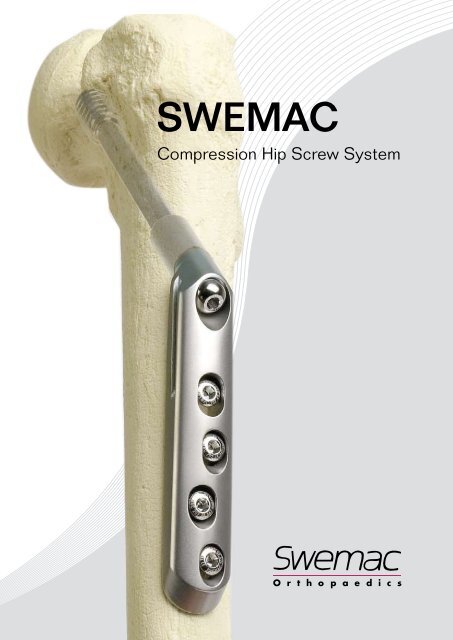 sWemaC - Osteosyntese
