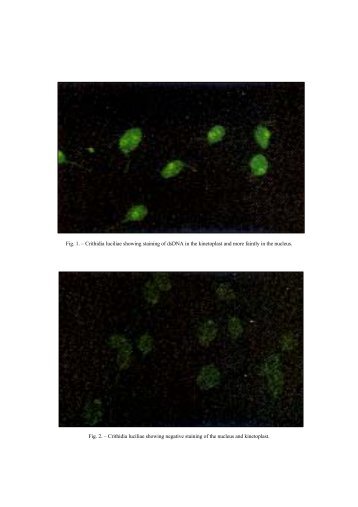 Fig. 1. â Crithidia luciliae showing staining of dsDNA in ... - Intmed.ro