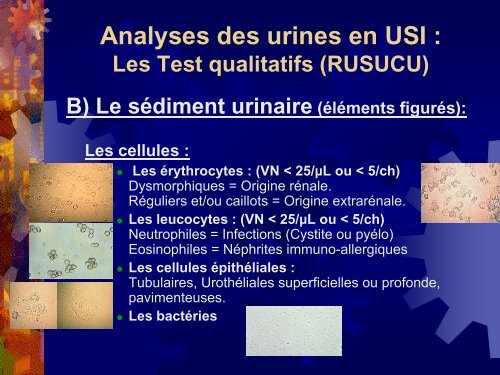 lanalyse des urines en soins intensifs - Service de nÃ©phrologie dialyse