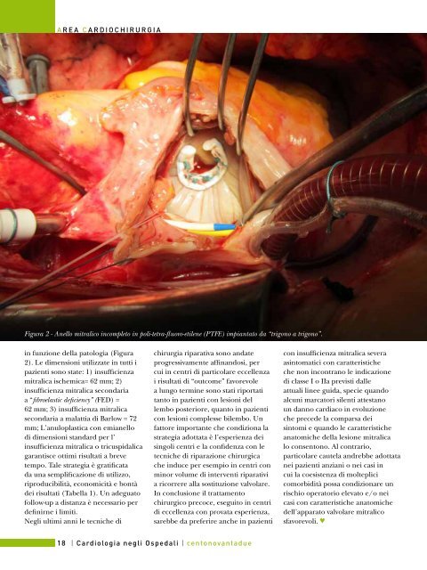 Cardiologia negli Ospedali nÂ° 192 Marzo / Aprile 2013 - Anmco