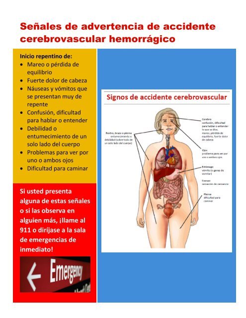 Accidente cerebrovascular hemorrÃ¡gico - UNM Hospitals