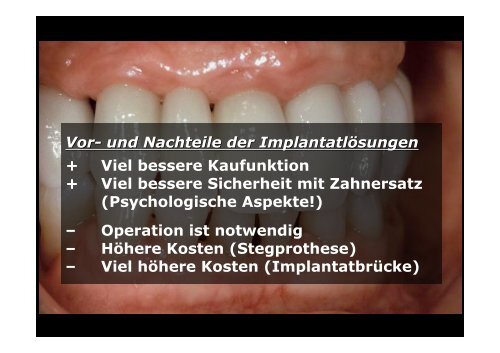 Homepage Implantate - zahnmedizinische kliniken zmk bern ...