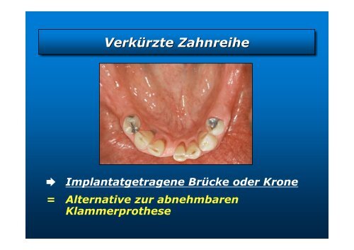 Homepage Implantate - zahnmedizinische kliniken zmk bern ...