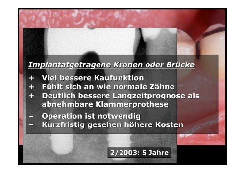 Homepage Implantate - zahnmedizinische kliniken zmk bern ...