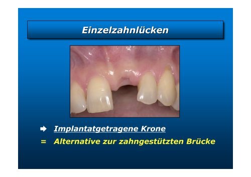 Homepage Implantate - zahnmedizinische kliniken zmk bern ...