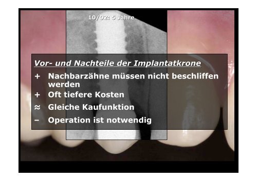 Homepage Implantate - zahnmedizinische kliniken zmk bern ...