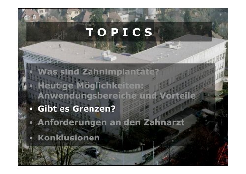 Homepage Implantate - zahnmedizinische kliniken zmk bern ...