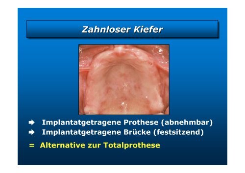 Homepage Implantate - zahnmedizinische kliniken zmk bern ...