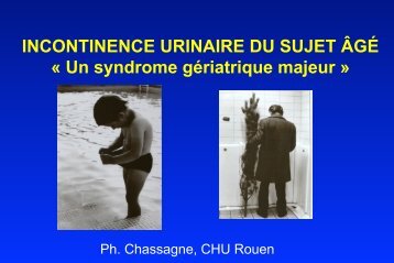 INCONTINENCE URINAIRE DU SUJET ÂGÉ « Un syndrome ... - PIRG