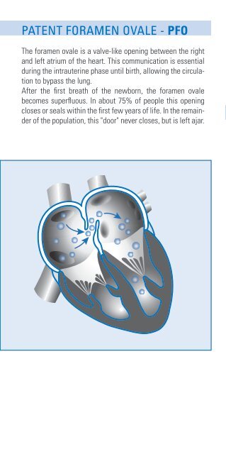 Flyer PFO - Suhms