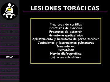 lesiones torácicas