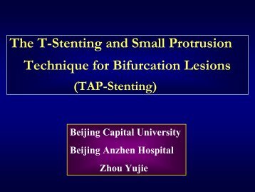 The T-Stenting and Small Protrusion Technique for Bifurcation Lesions
