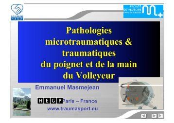 Pathologies de la main et du poignet au Volley-ball ... - Extranet FFVB