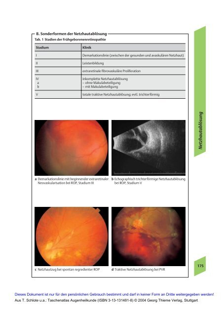 Taschenatlas Augenheilkunde (Thieme Verlag, 2004)