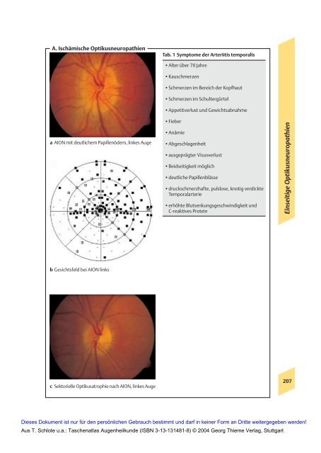 Taschenatlas Augenheilkunde (Thieme Verlag, 2004)