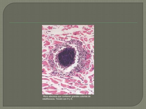 clase pericarditis-miocarditis dr. javier orozco - Departamento de ...