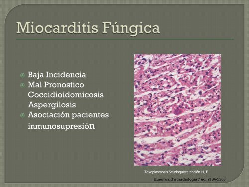 clase pericarditis-miocarditis dr. javier orozco - Departamento de ...