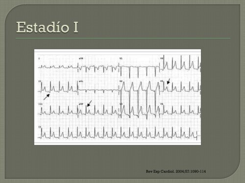 clase pericarditis-miocarditis dr. javier orozco - Departamento de ...