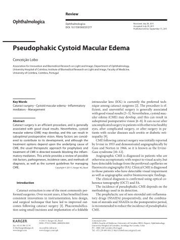 Pseudophakic Cystoid Macular Edema - RIHUC