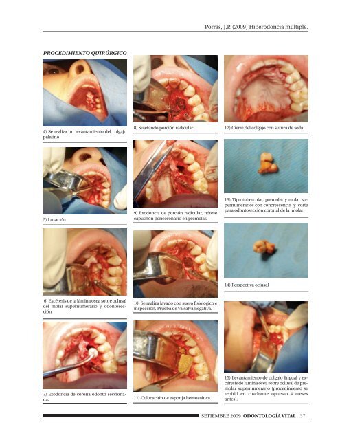 OdontoFINALRespaldo 11. Sin publicidad pdf - My Laureate