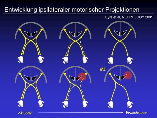 Staudt et al, Brain 2002; Ann Neurol 2004 - Kinderzentrum ...