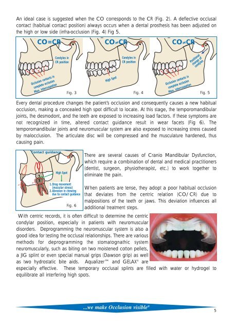 Bausch Articulating Papers - Janouch Dental