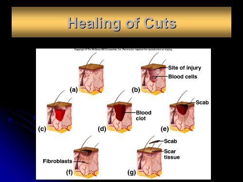 Chapter 6 Skin and the Integumentary System - Arkansas State ...