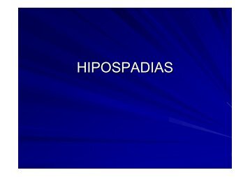 HIPOSPADIAS