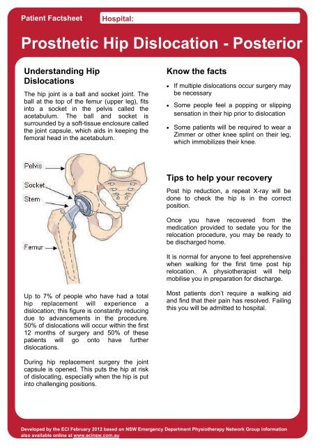 Prosthetic Hip Dislocation - Posterior