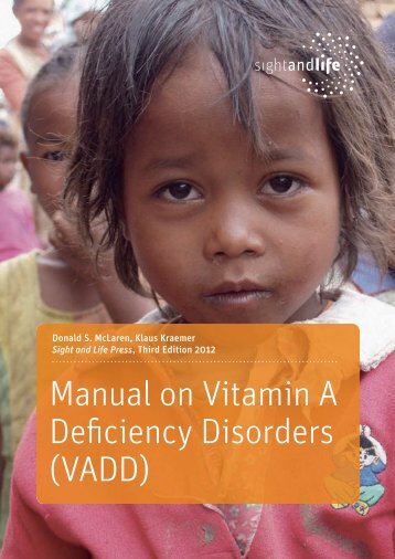 Manual on Vitamin A De ciency Disorders (VADD) - Sight and Life