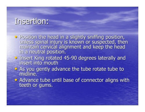 King Airway PowerPoint Presentation