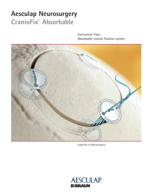 Doc 561-CranioFix Absorbable - Aesculap
