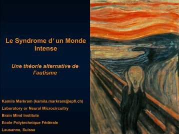 Syndrome d'un Monde Intense - LASA - EPFL