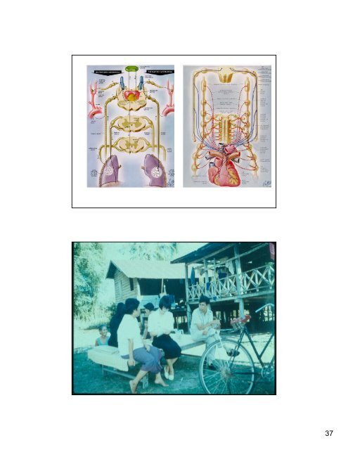 Sudden Unexplained Nocturnal Death Syndrome SUNDS - Mahidol