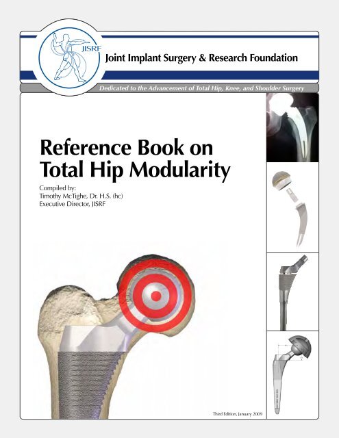 Reference Book on Total Hip Modularity - Joint Implant Surgery ...