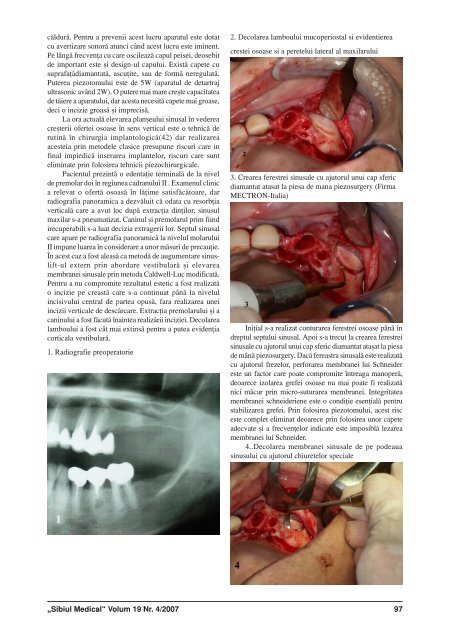 Sibiul Medical nr 4_2007.p65