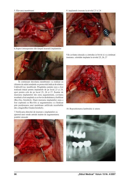 Sibiul Medical nr 4_2007.p65