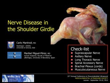Nerve Diseases
