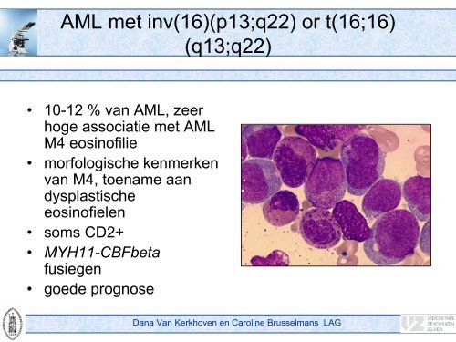 Diagnose en classificatie van acute leukemieÃ«n - UZ Leuven