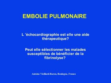 Vieillard-Baron A - Embolie pulmonaire - SRLF