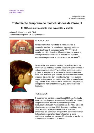 Tratamiento temprano de maloclusiones de Clase III