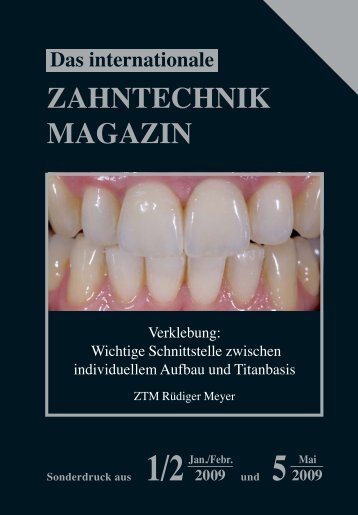 ZAHNTECHNIK MAGAZIN - Wieland Dental