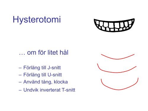 SFOG-presentation